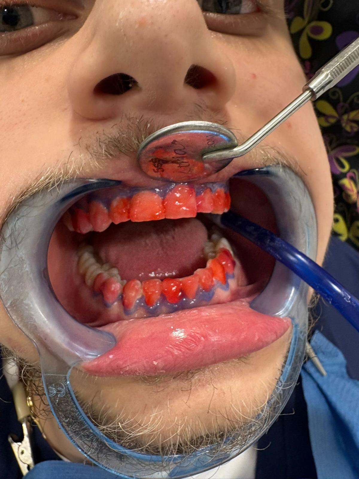 Estetică facială — rezultat complet